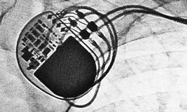 激光焊接在醫(yī)療行業(yè)技術(shù)中的應(yīng)用